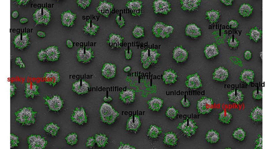 Scanning electron microscopy and machine learning reveal heterogeneity in capsular morphotypes of the human pathogen Cryptococcus spp.